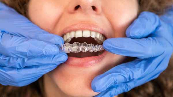 Invisalign Bexhill 