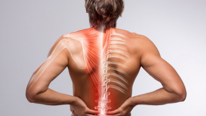 Carisoprodol 350 mg for Chronic Back Pain: Is It Effective?