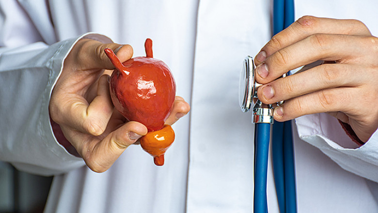 What to Expect After Prostate Surgery