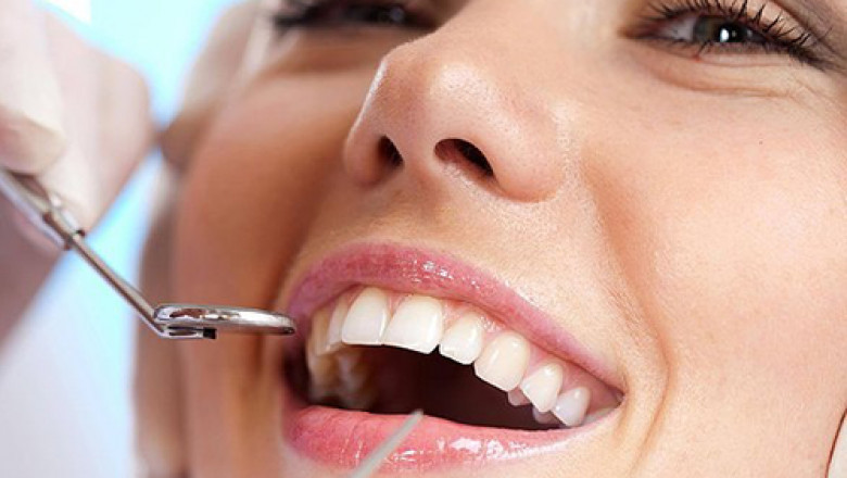 Fixed Dentures in Tampa: A Comprehensive Guide to a Permanent Smile Solution