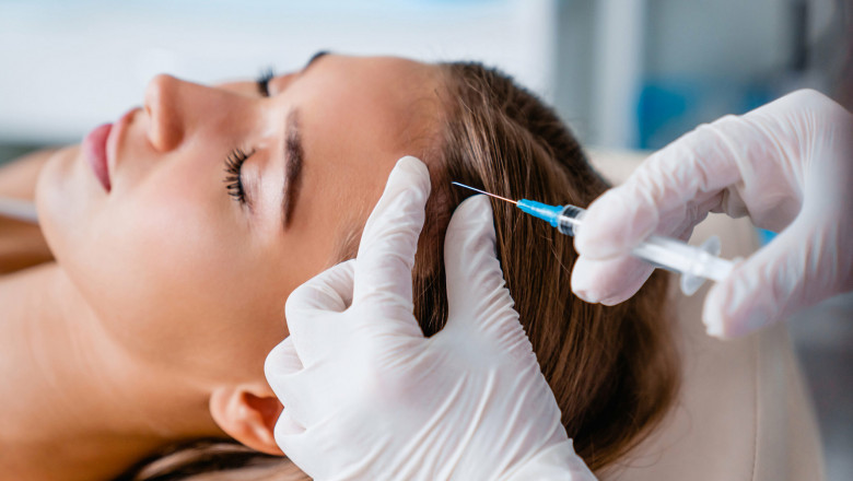 What to Expect During Your PRP Hair Treatment Session