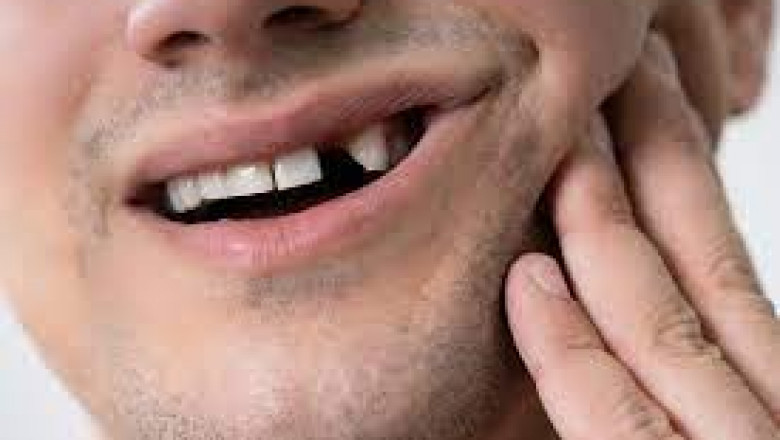 Fastest Way to Access an Emergency Dentist Near You