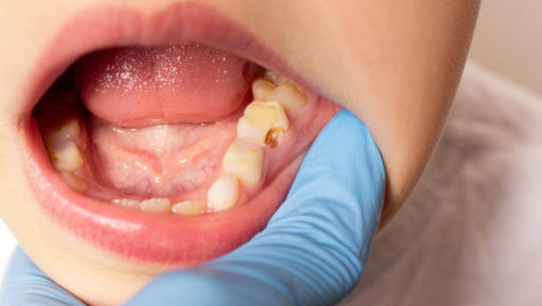The Fastest Way to Access an Emergency Dentist Near You