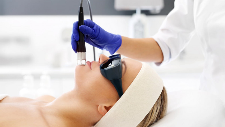 Laser Treatment for Rosacea: A Safe Solution to Redness