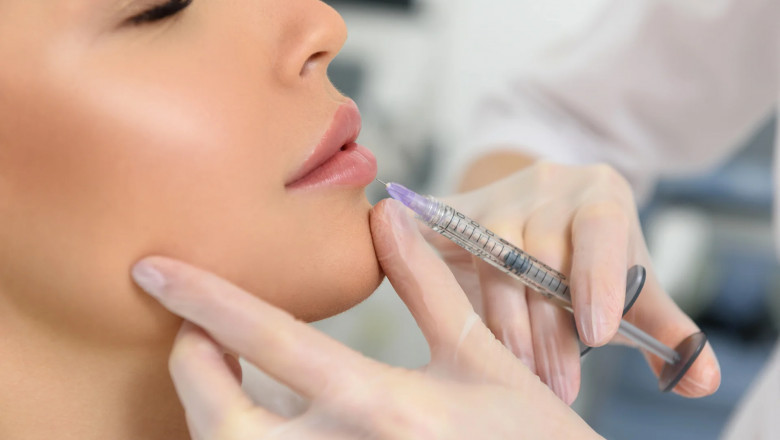 Russian Lip Fillers and Facial Symmetry: Why It Matters