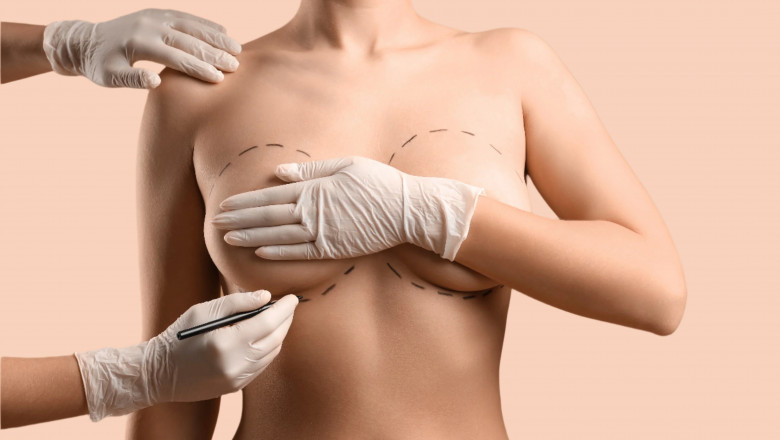Best Breast Enhancement Surgeon in Dubai: How to Achieve Natural-Looking, Proportional Breasts