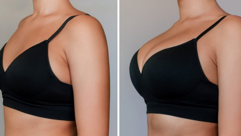 Breast Enlargement: How to Achieve Natural-Looking Results with Breast Enlargement