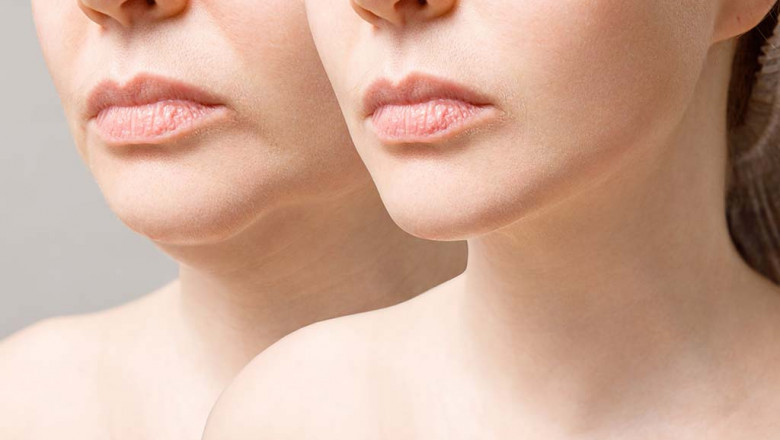 Top 7 Facial Plastic Surgery Combos for Comprehensive Results
