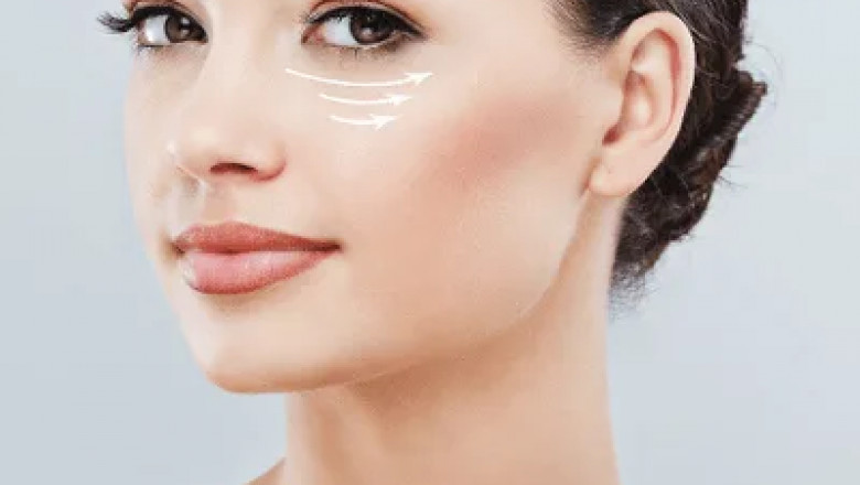 How Eyelid Bag Surgery in Dubai Can Restore a Youthful Appearance