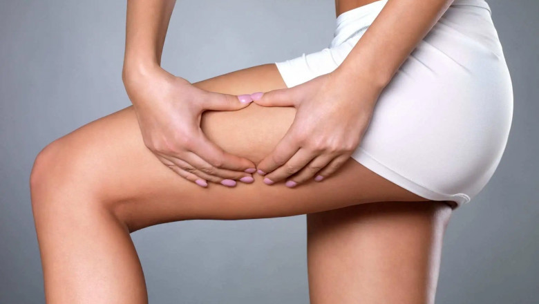 Why a Thigh Lift in Jeddah Is Gaining Popularity Among Patients