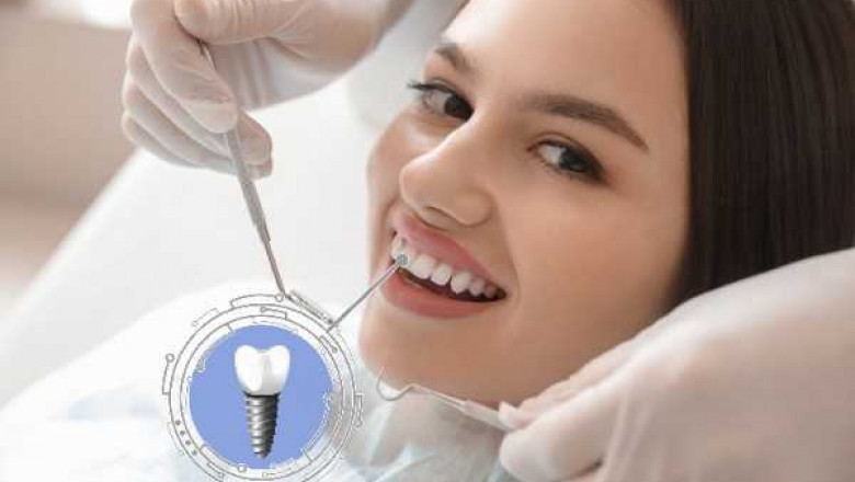 How Local Professionals are Enhancing Smiles in Bexhill