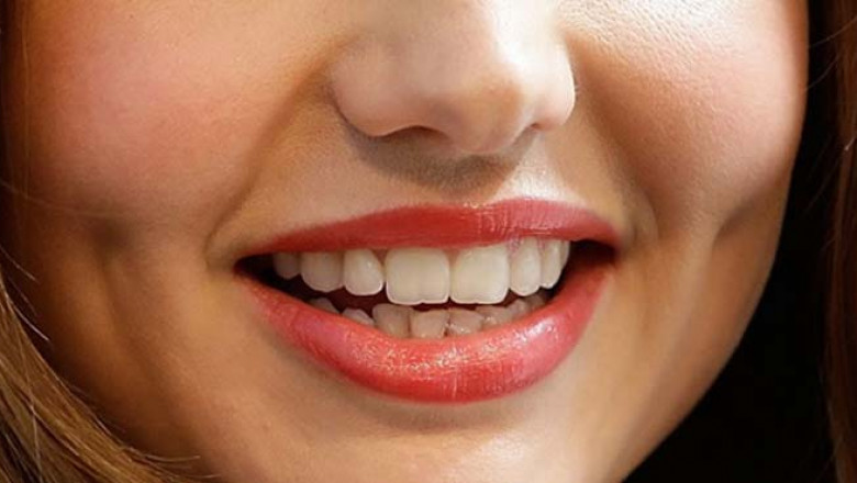 Why Dimples Are Still Trending in 2025: Beauty Experts Weigh In