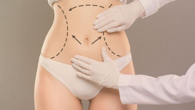 Best Tummy Tuck Surgeon in Dubai: How to Choose the Right Professional