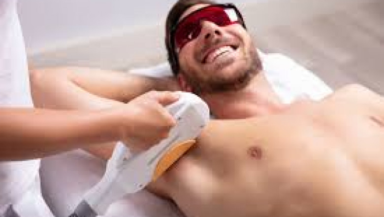 What Happens If You Miss a Laser Hair Removal Session?